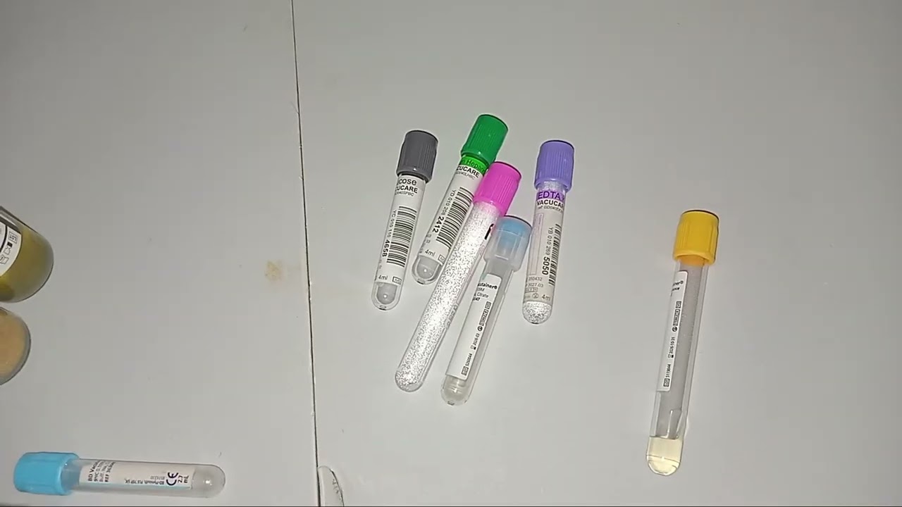 The difference between plasma, serum and whole blood specimen.  