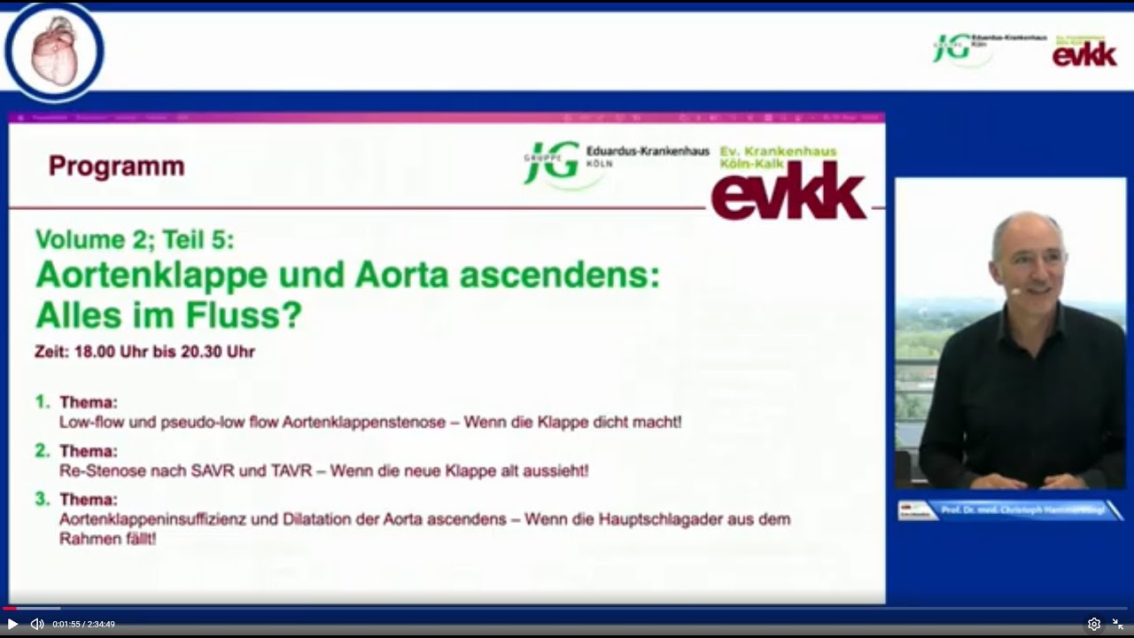 "ECHO-Interaktiv: Live aus Köln": September 2025: Aortenklappe und Aortaascendens: Alles im Fluss?