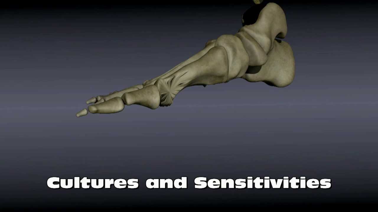 Osteomyelitis