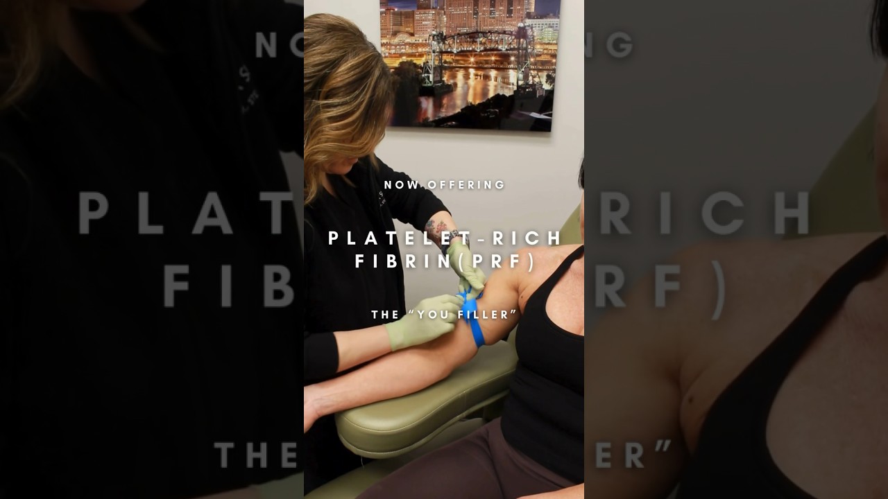 Platelet Rich Fibrin (PRF): The "You Filler" 💉 ✨ 