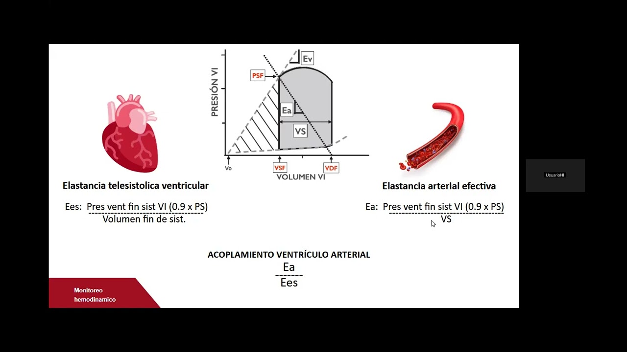 Elastancia Arterial (20/11/2024 Dr. Eduardo Prado)