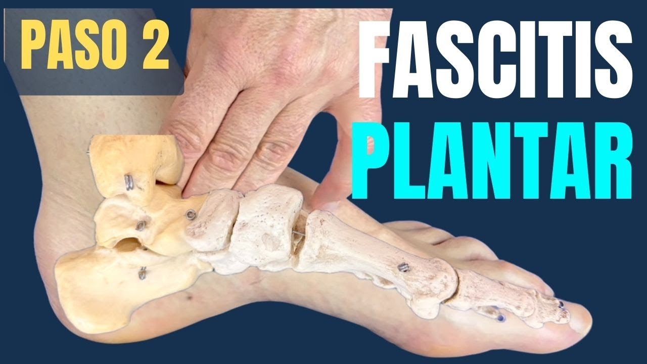 🦶 5 PASOS para desbloquear tu pie y ALIVIAR la FASCITIS PLANTAR | Paso 2 desde casa