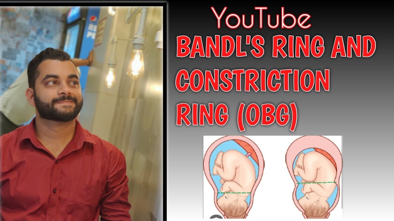 BANDL'S RING AND CONSTRICTION RING (CONTRACTION RING) #nursingofficer #aiims #norcet #nursingstudent