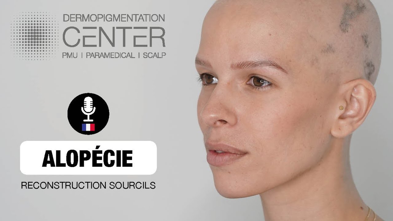 Manon partage son expérience face à l'alopécie universelle et s'oriente vers la Dermopigmentation