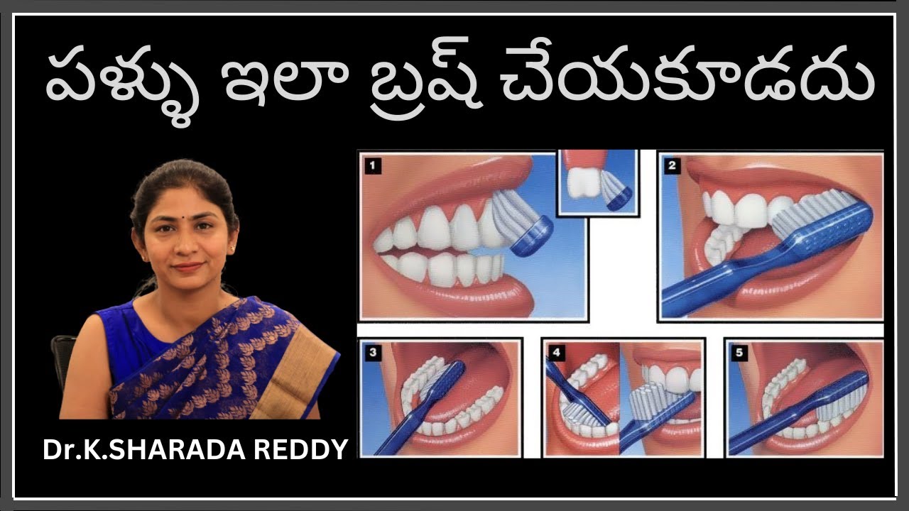 బ్రష్ ఇలా చేస్తునారా | HOW TO BRUSH YOUR TEETH | పళ్ళు ఇలా బ్రష్ చేసుకోవాలి | DR.K.SHARADA  #telugu