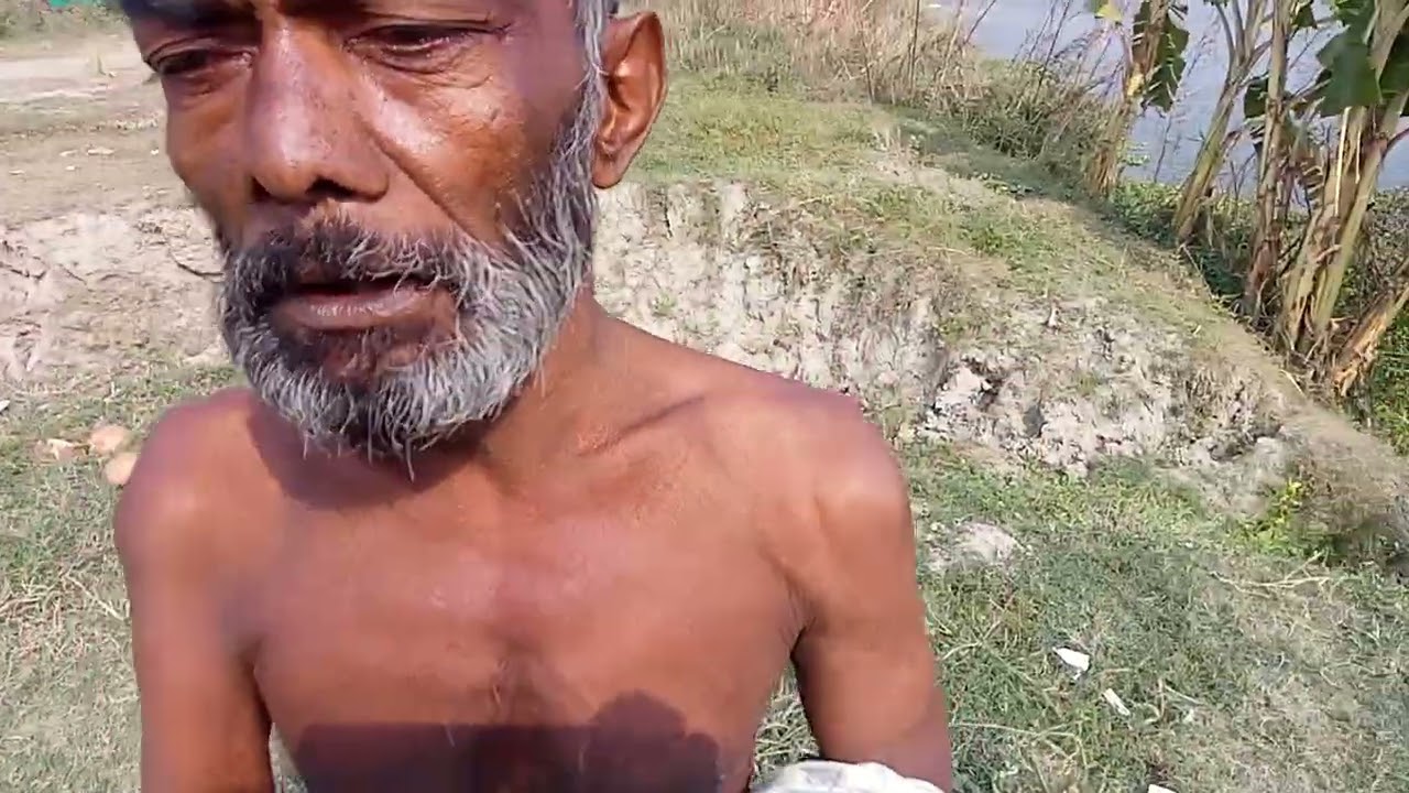 সুস্থ ব্যক্তি হঠাৎ প্যারালাইজড হয়ে গেল# reels#bangladesh 
