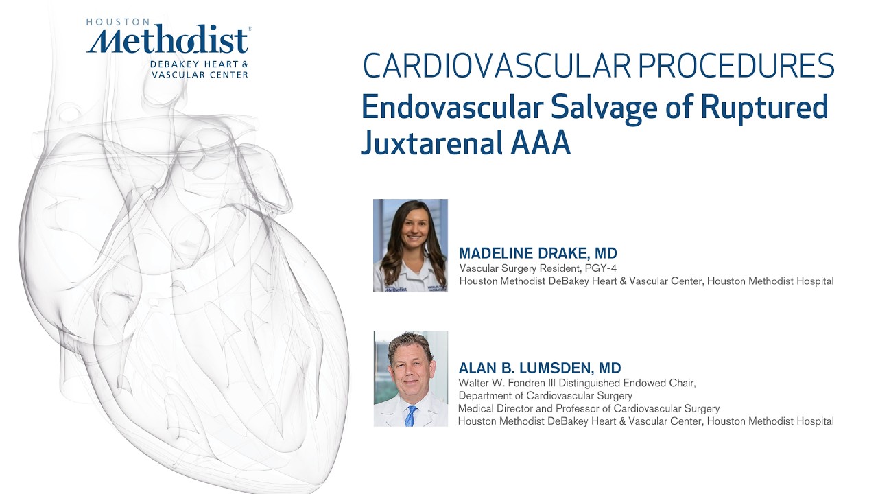 Endovascular Salvage of Ruptured Juxtarenal AAA