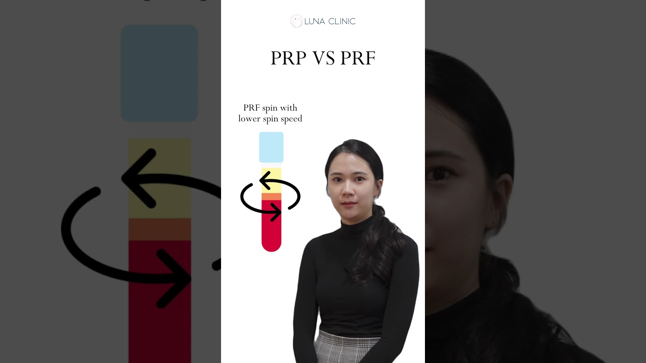 Comparison of Platelet-Rich fibrin (PRF) & Platelet-rich plasma (PRP)