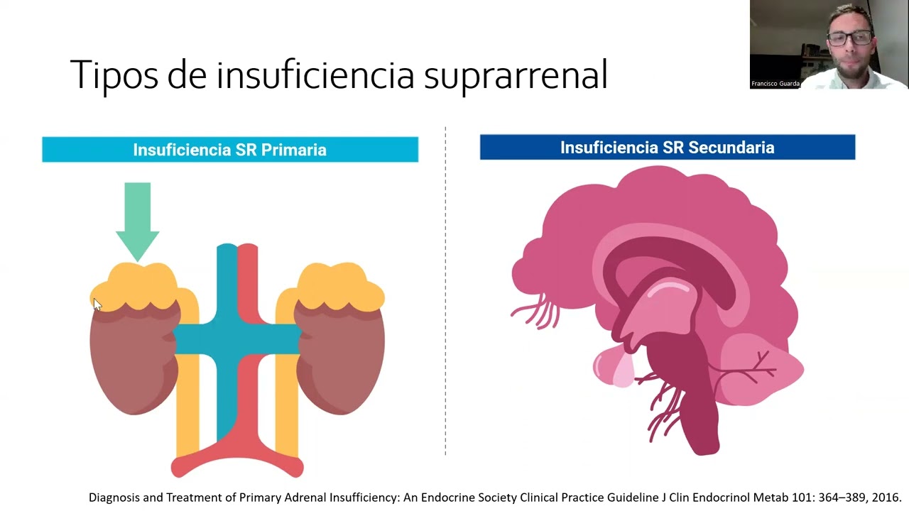 clase 3 insuf sr y ap hip