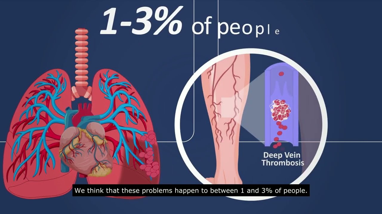 Research to reduce DVT (blood clots) following varicose vein treatment. The THRIVE Trial