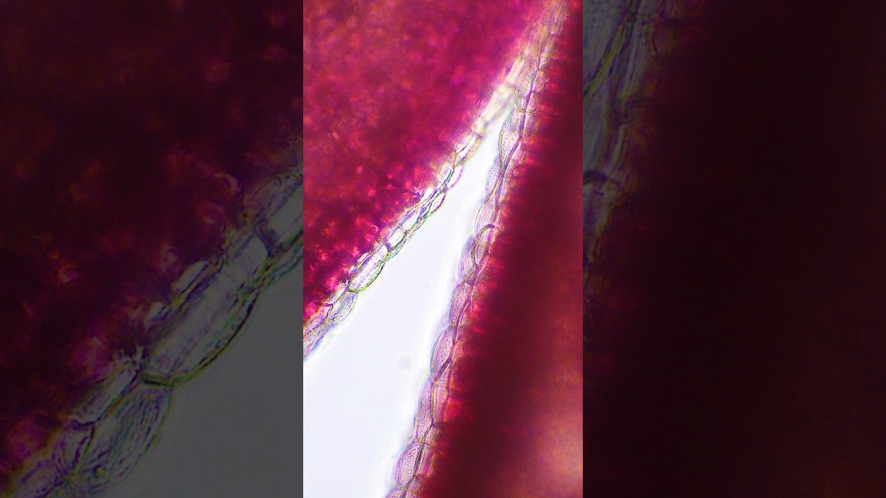 This Leaf Looks Like a Strawberry Party!  #microscope #biology #science #nature