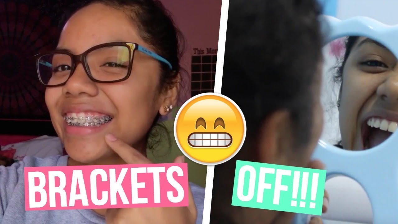 ME QUITAN LOS BRACKETS!! | Johanna De La Cruz