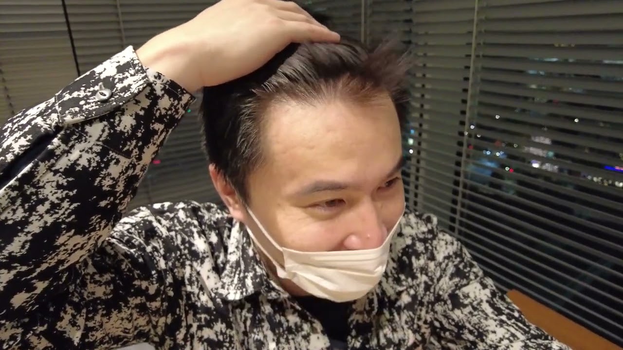 俺は禿なのか？