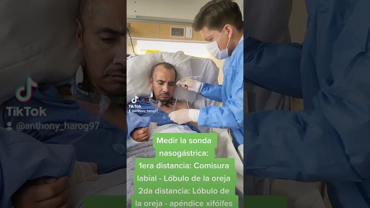 Colocaci&oacute;n de sonda nasog&aacute;strica
