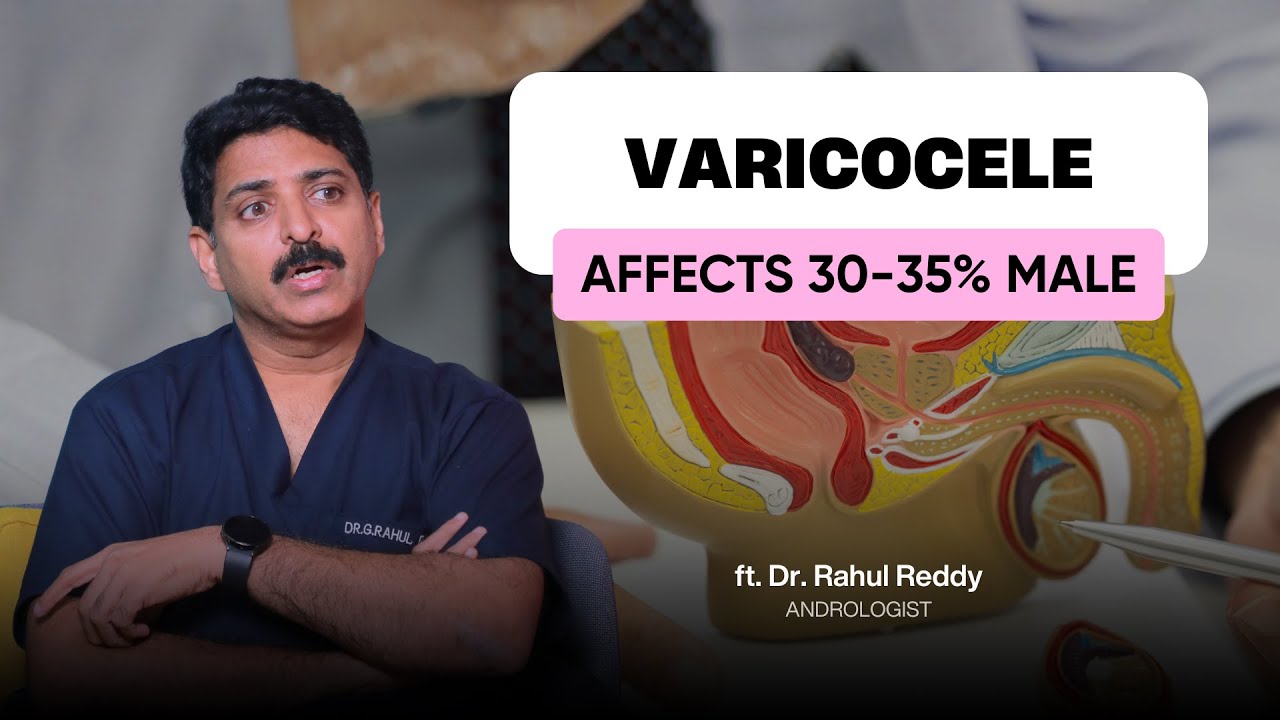 Varicocele Explained: Common Cause of Male Infertility