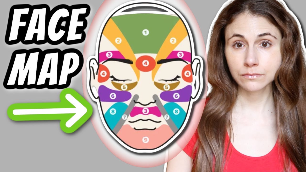 What can FACE MAPPING YOUR ACNE tell you? | Dr Dray