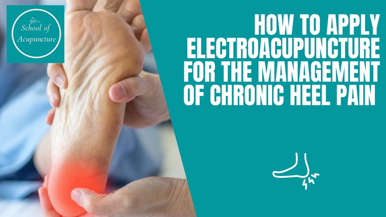 How to apply electroacupuncture for the management of chronic heel pain