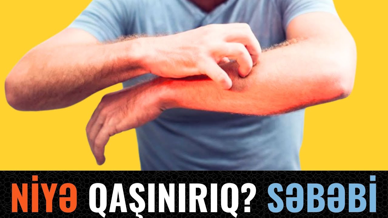 Niyə qaşınırıq? Səbəbi və çarəsi