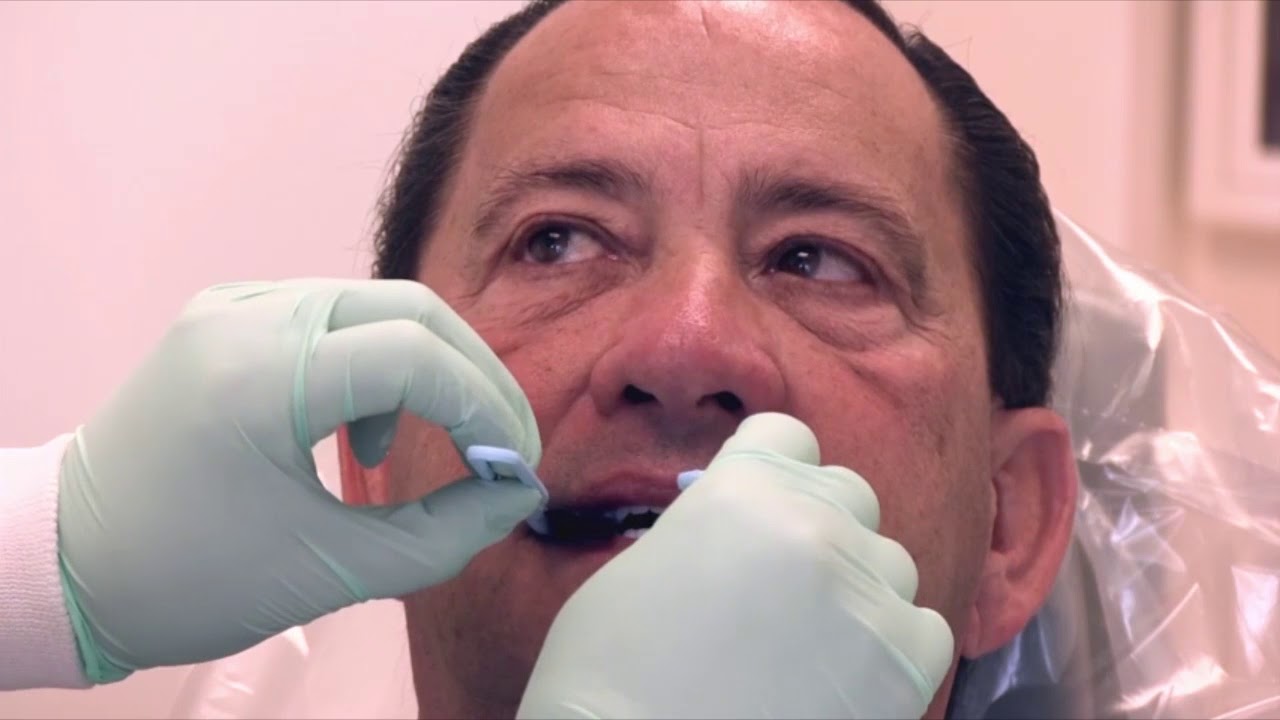DENTCA Impressions Step 5 - Try-In Appointment
