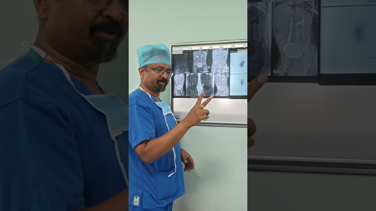 VUR management does not need open surgery anymore