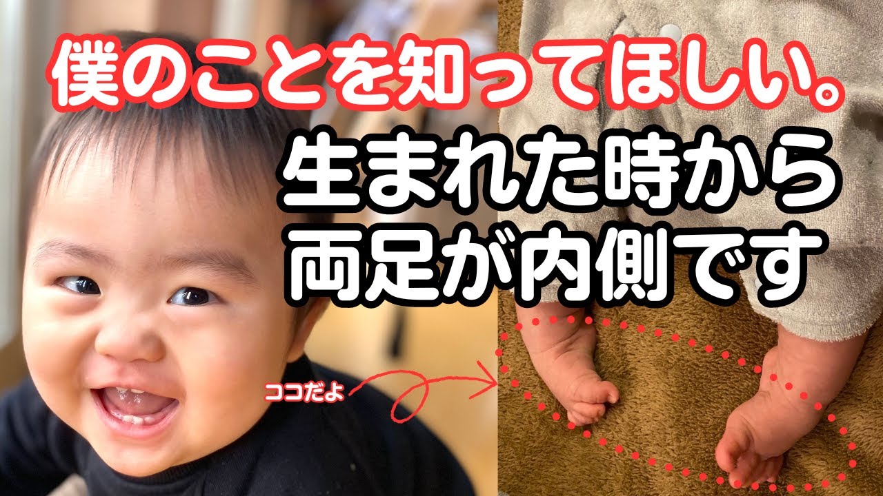 【先天性内反足】僕の手術後から装具になるまでの道のり