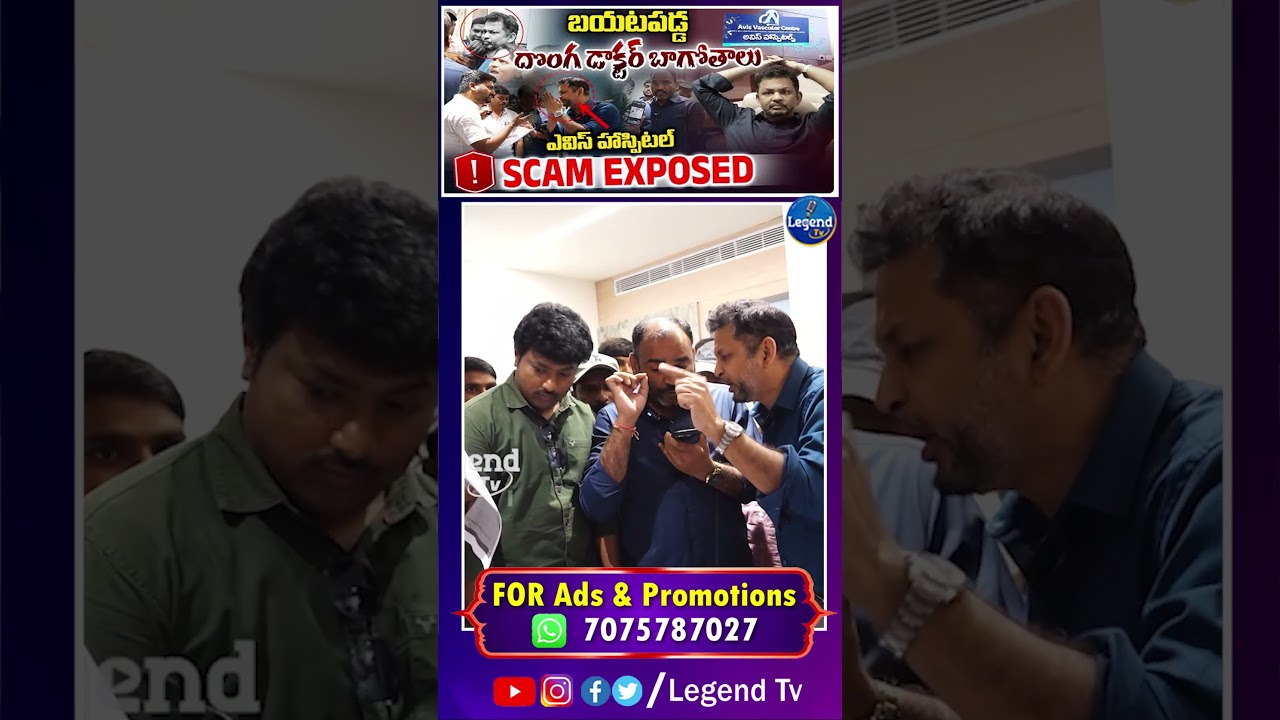 Avis Hospital Scam Exposed 🛑 | Avis vascular centre Hyderabad | Legend Tv