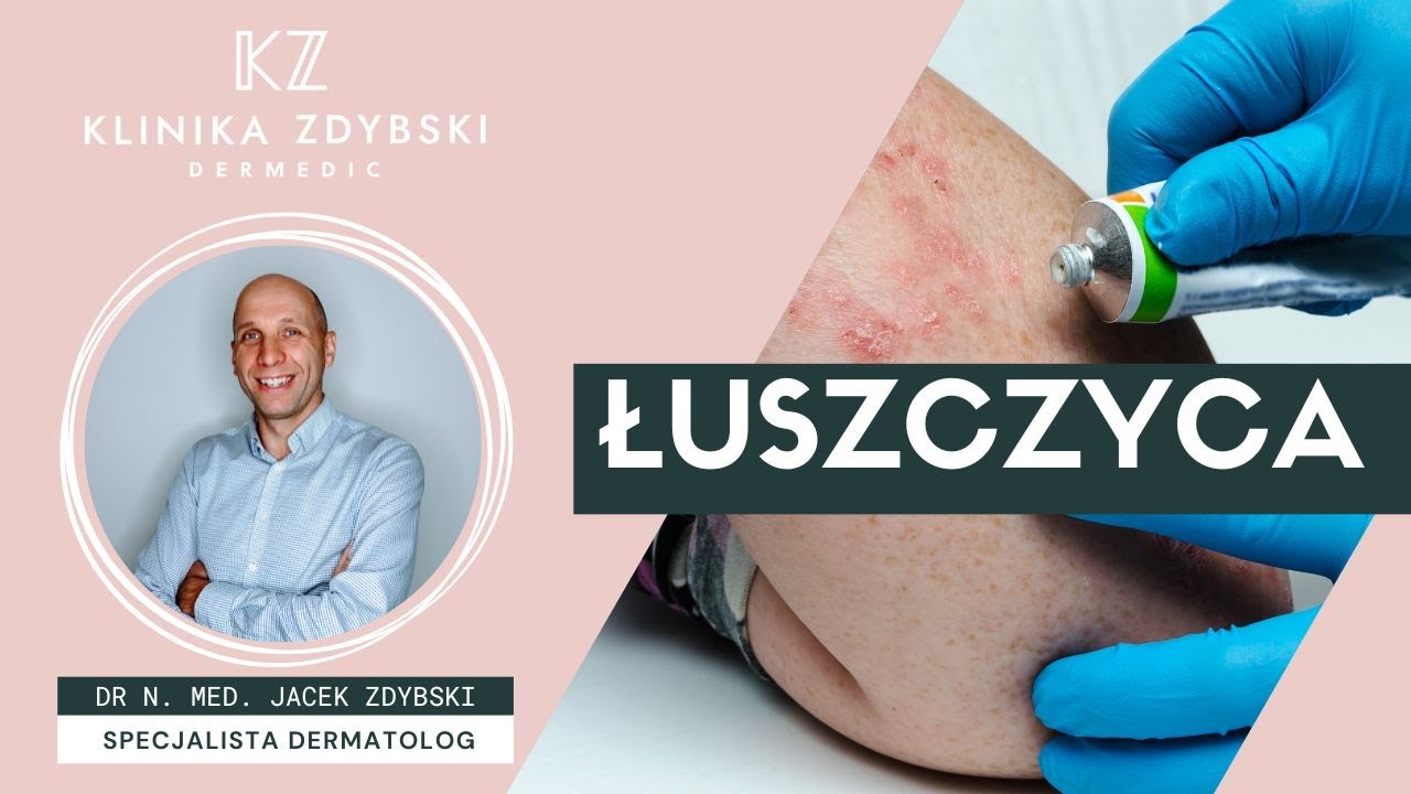 Dermatolog mówi o: Łuszczyca