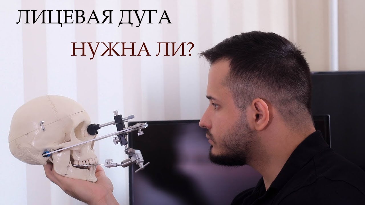 ЛИЦЕВАЯ ДУГА! А ТАК ЛИ ОНА НУЖНА?