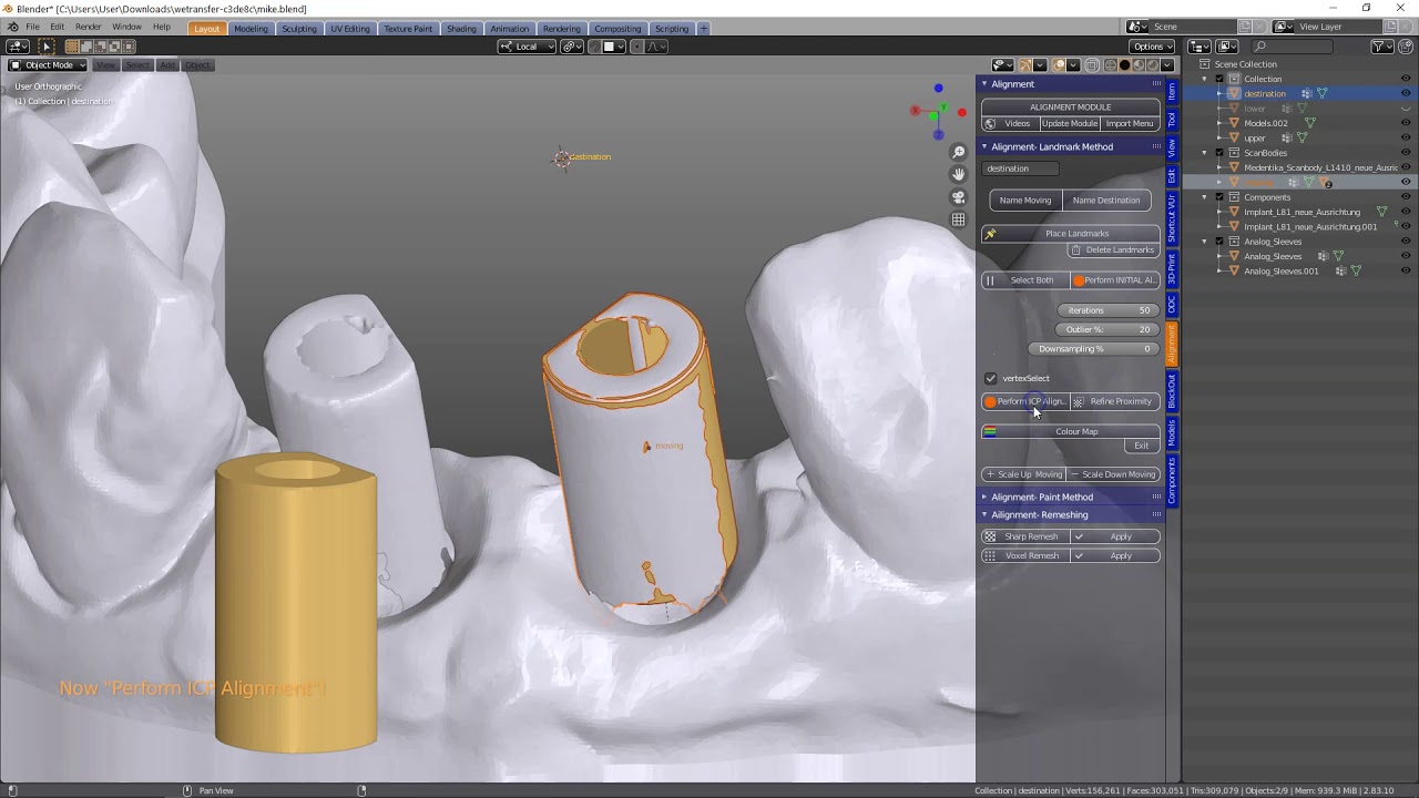 B4D Implant Gum Model