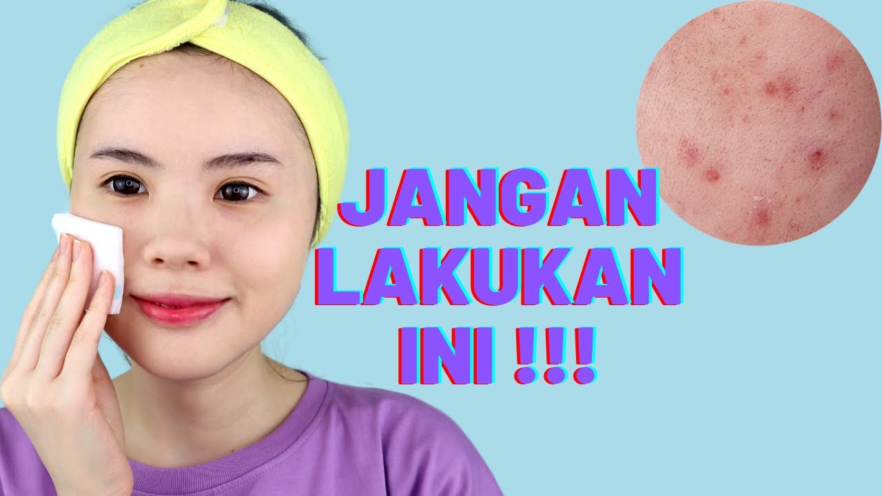 5 Kesalahan Skincare yg Bikin Jerawat Makin Parah dan Kulit Jadi Sensitif (INI SEBABNYA!)