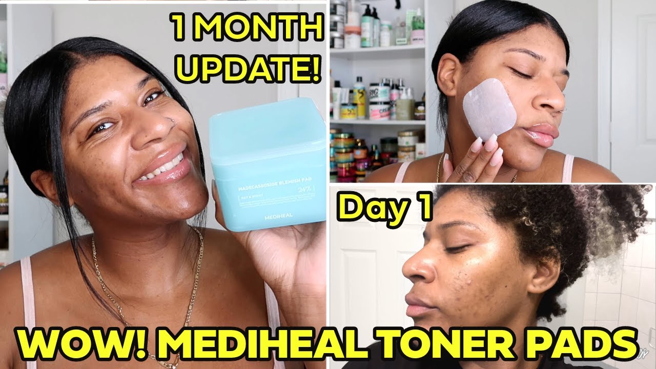 Mediheal Toner Pads: 30 Day Journey to Clearer Skin | K Beauty Black Girl Edition