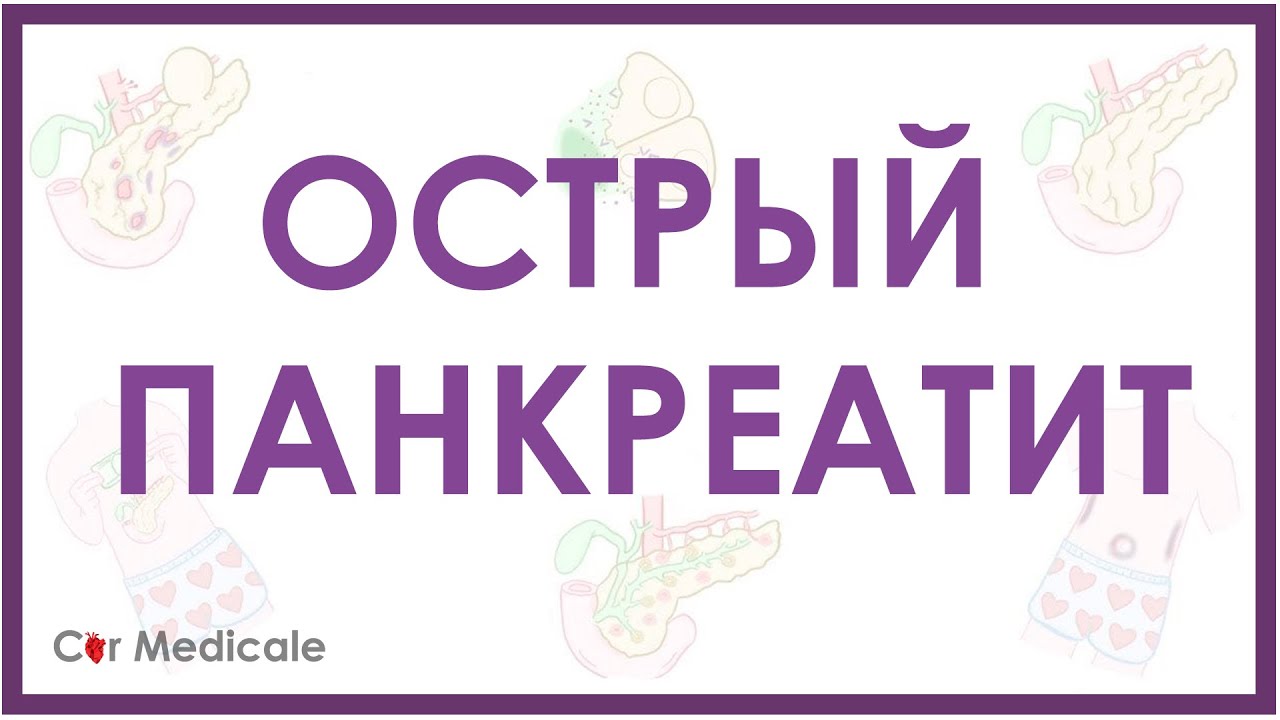 Острый панкреатит - кратко о причинах и патогенезе