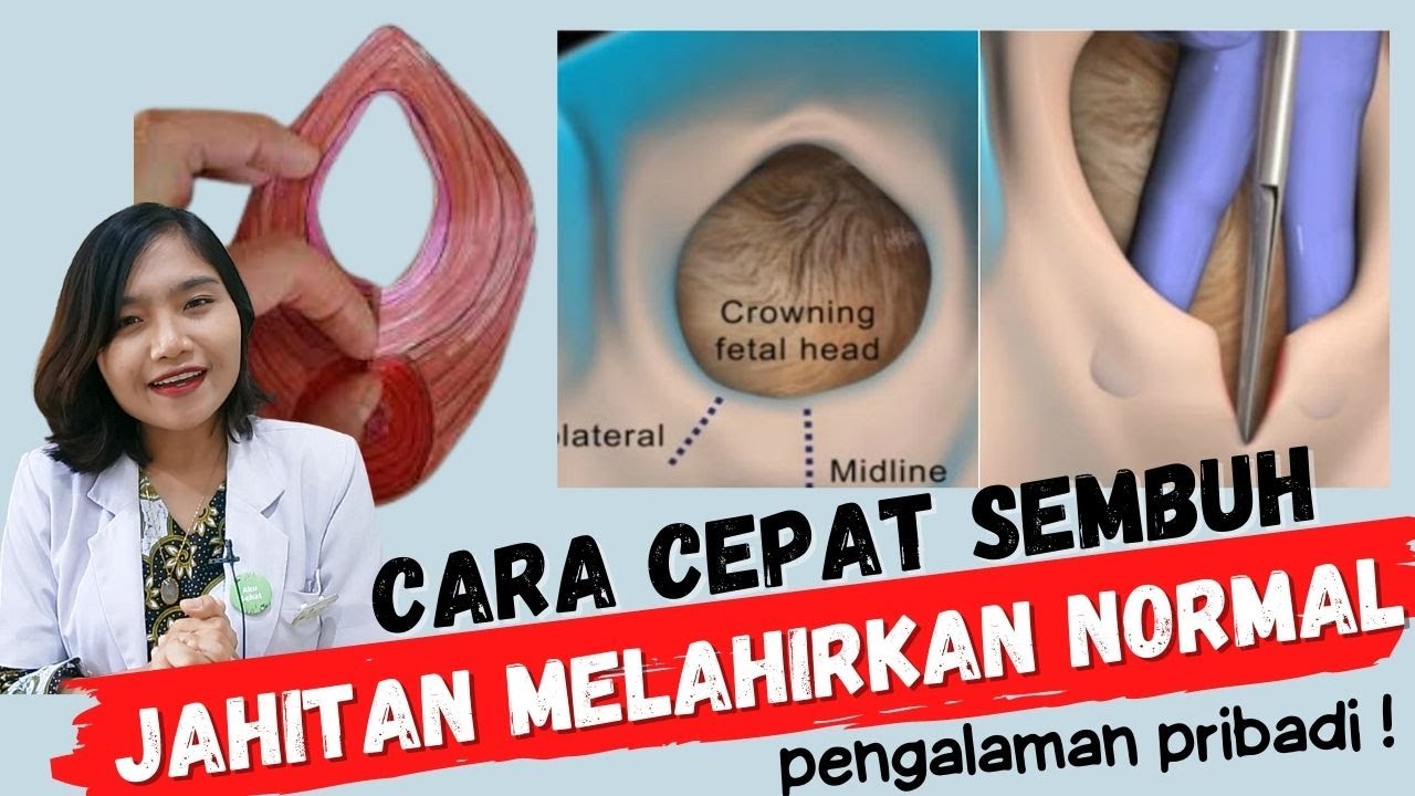 Cara Cepat Sembuh dari Jahitan Melahirkan Normal | dr. Ema Surya P