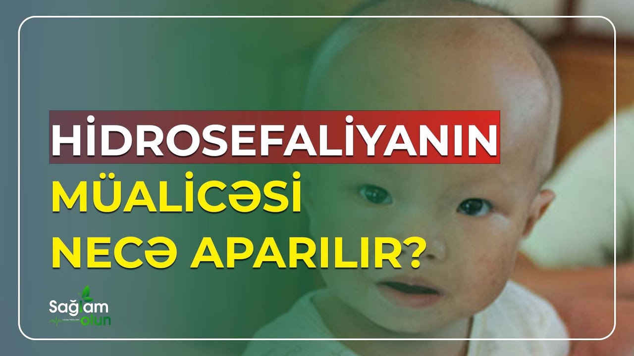 HİDROSEFALİYANIN MÜALİCƏSİ NECƏ APARILIR?
