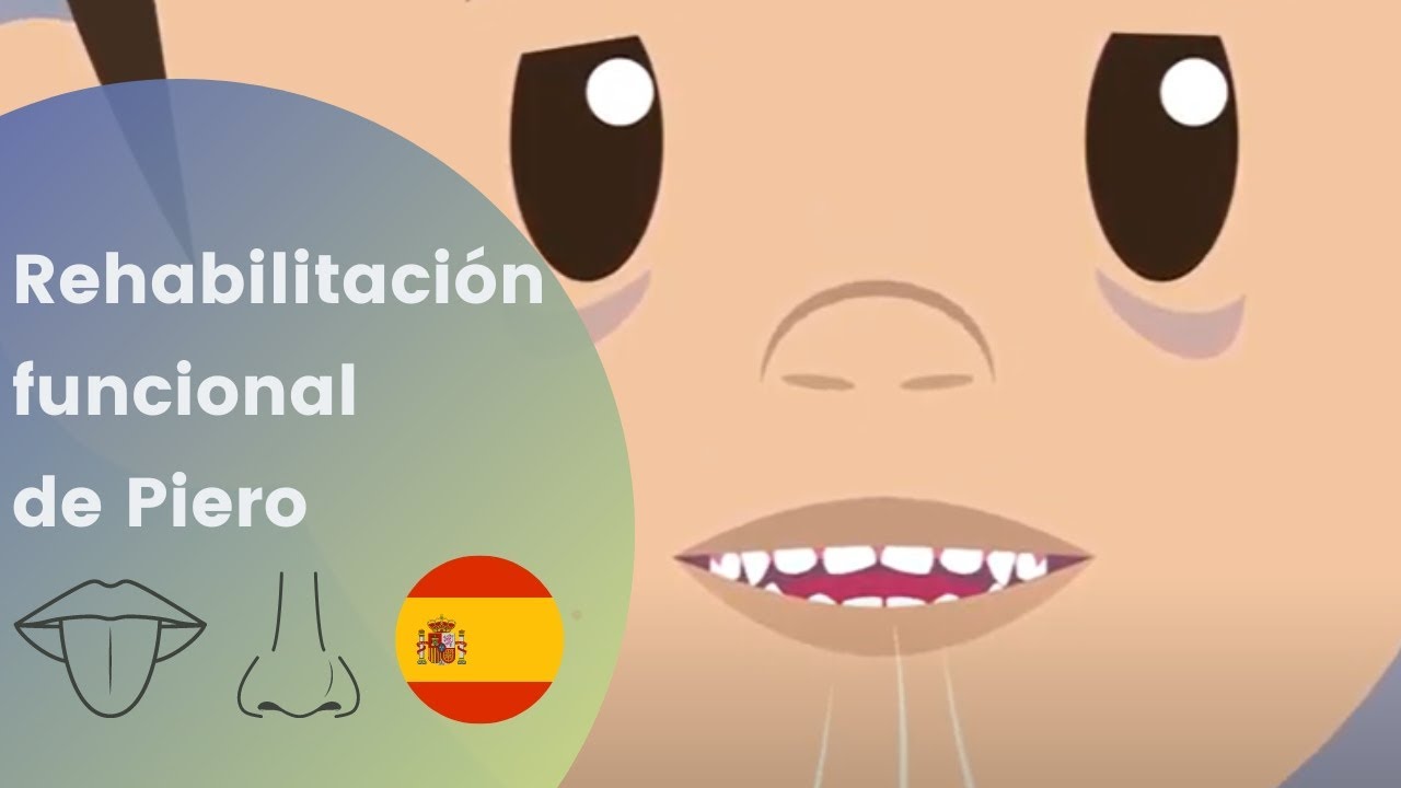 ¿Por qué necesito rehabilitación funcional? - Froggymouth