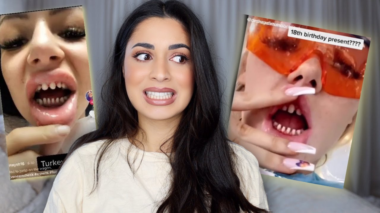 Veneers Trend von Influencer muss aufhören