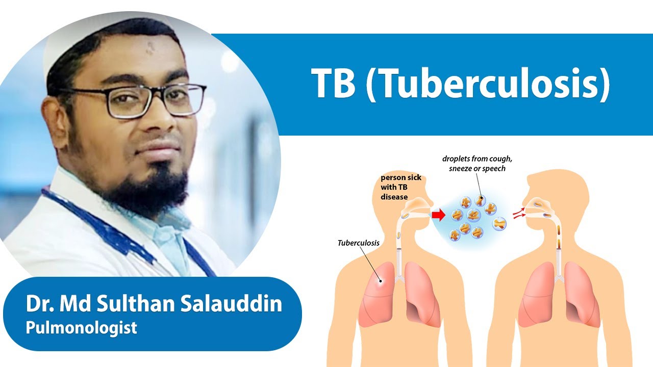 TB (tuberculous) Treatment | Dr. Sulthan Salauddin