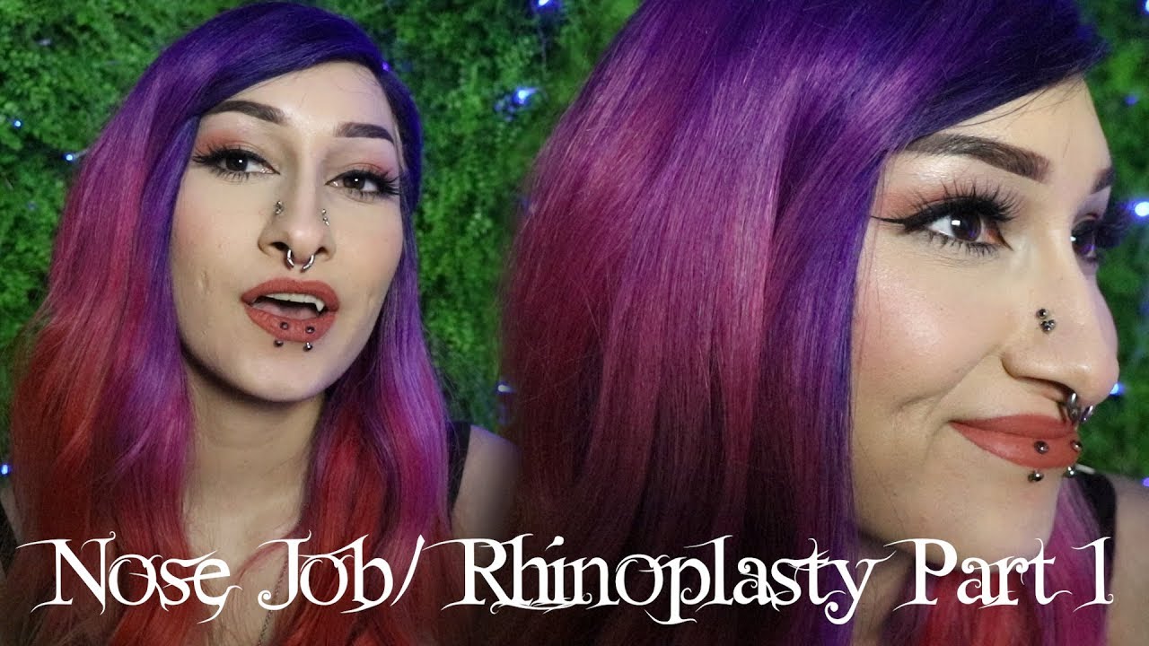 I GOT A NOSE JOB (RHINOPLASTY) + Why and Past Surgeries | Scream Kiwi