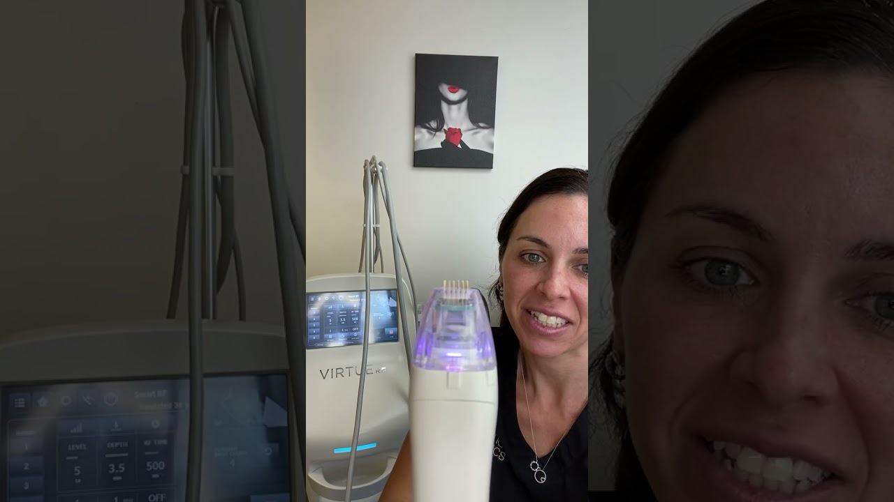 Virtue RF Microneedling Explained at Atlantic Aesthetics - Benefits, How It Works & What to Expect