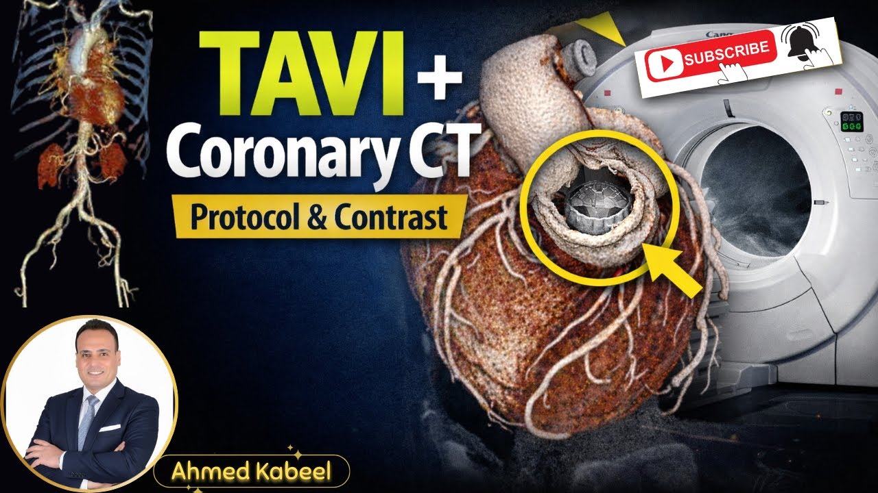 كيف تصور حالة TAVI احترافية؟ (تطبيق عملي على جهاز Canon).