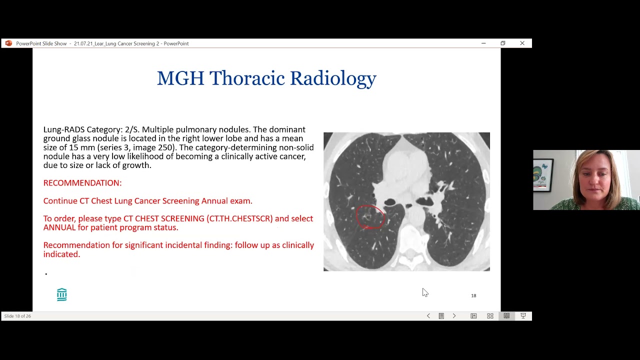 Newton-Wellesley Medical Group Lunch & Learn: Pulmonary nodule clinic