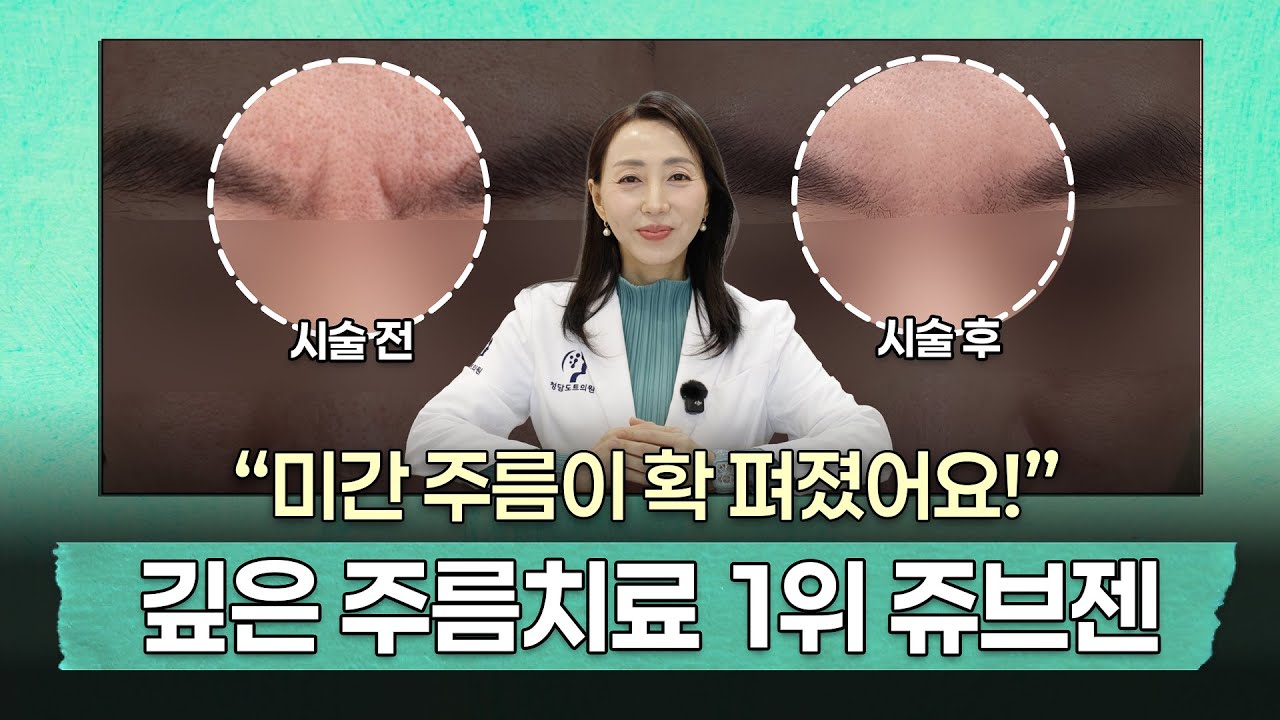 깊은 미간주름 없애는 치료 1위? 쥬브젠 자가진피재생술의 모든 것!｜QnA, 유지기간, 효과, 통증, 다운타임