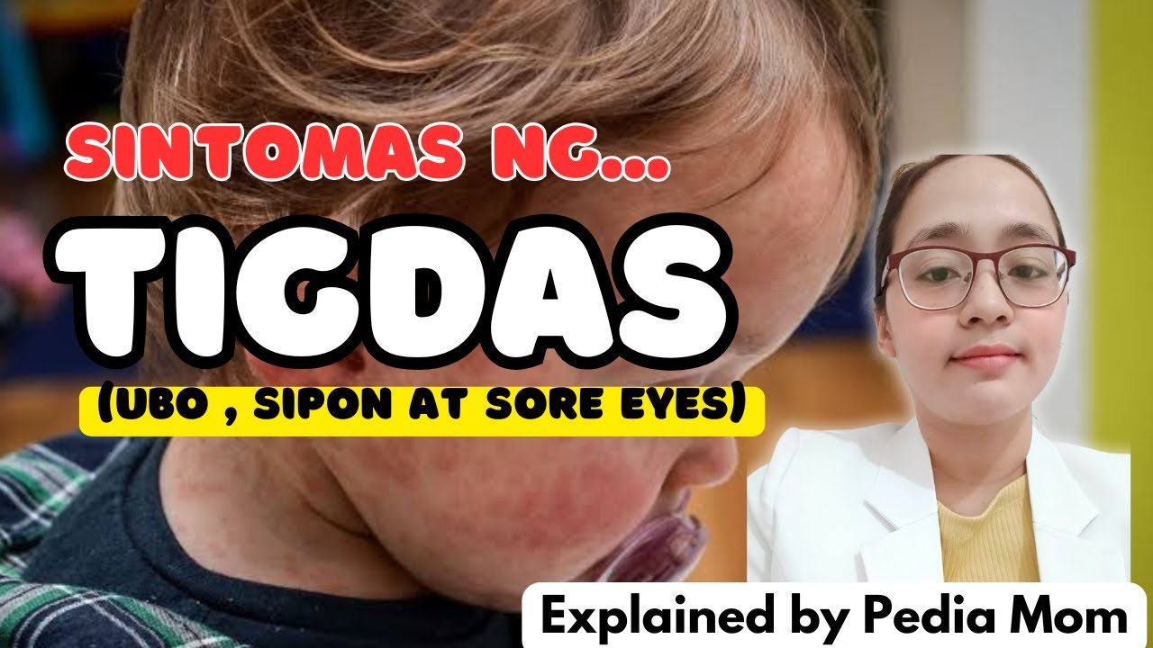 UBO, SIPON AT SORE EYES -- baka TIGDAS yan.. |Measles symptoms |Dr. PediaMom