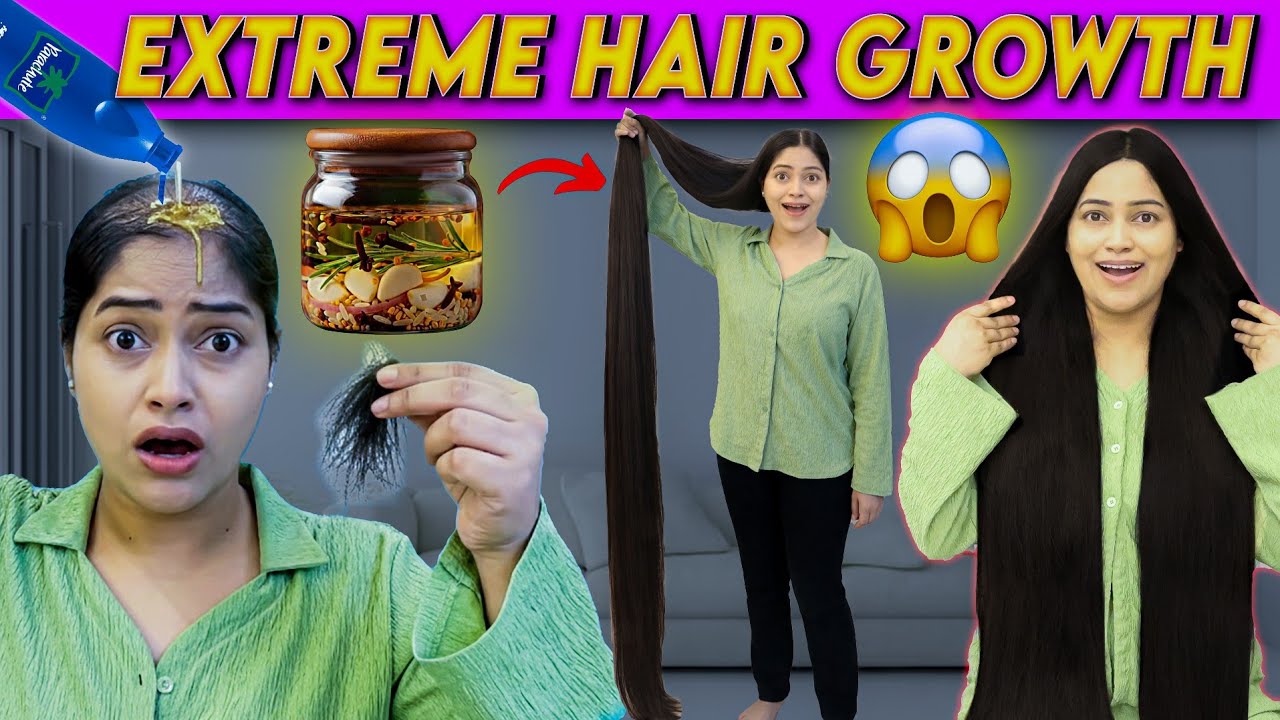 I Applied Few Drops Of This & Got Massive Hairgrowth On Bald Scalp😱 100% Effective Diy ForHairgrowth