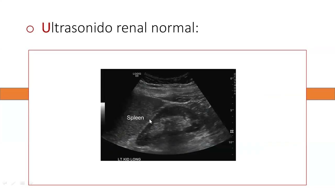 Nefrologia 1 2026