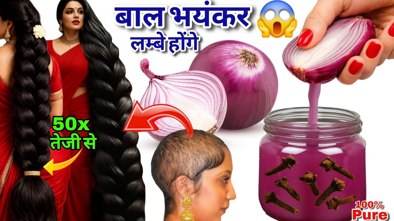 गंजेपन और हेयरफॉल का काल! 😱 DIY Onion Oil for 50x Hair Growth 💯 (बस 1 बार लगाओ)