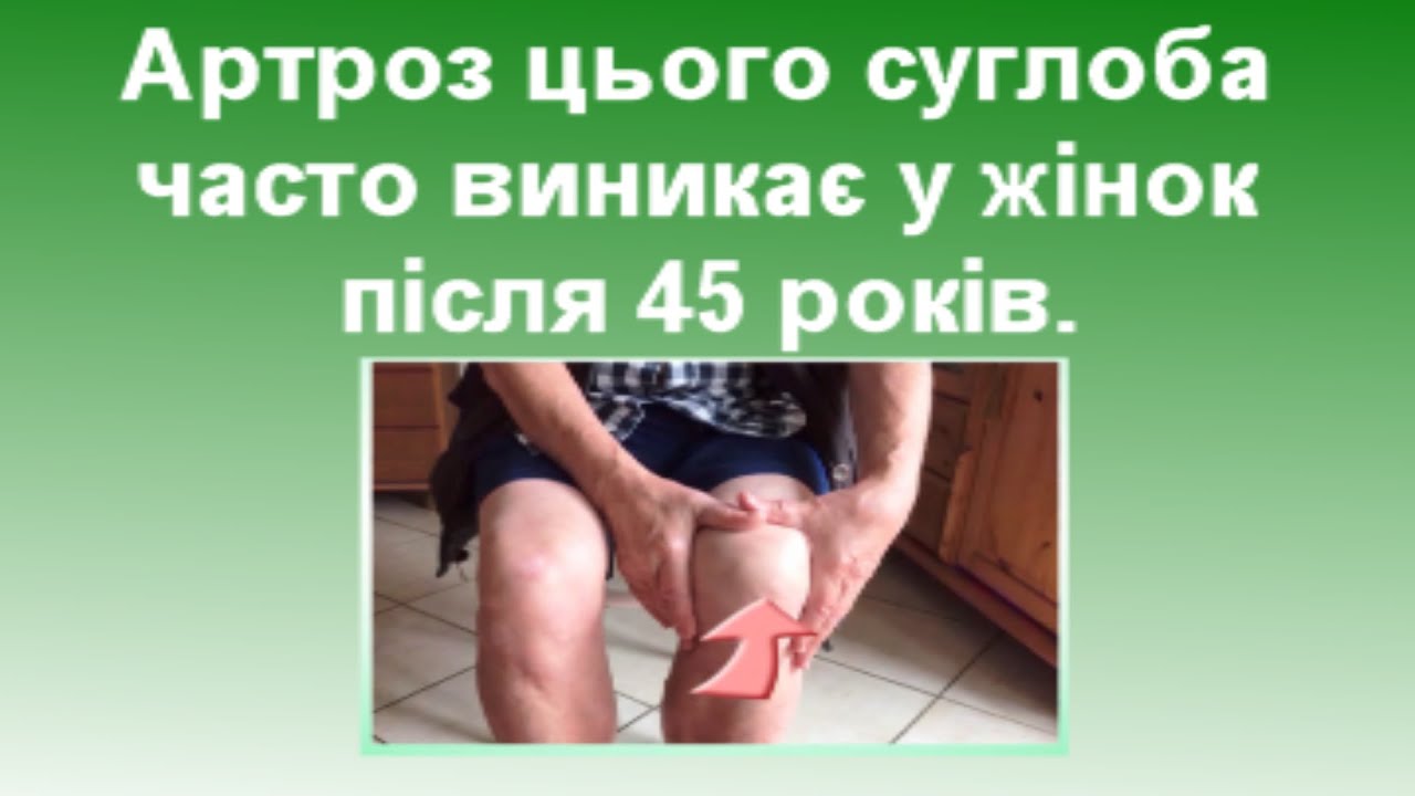 Анатомія колінного суглоба  Анатомія людини