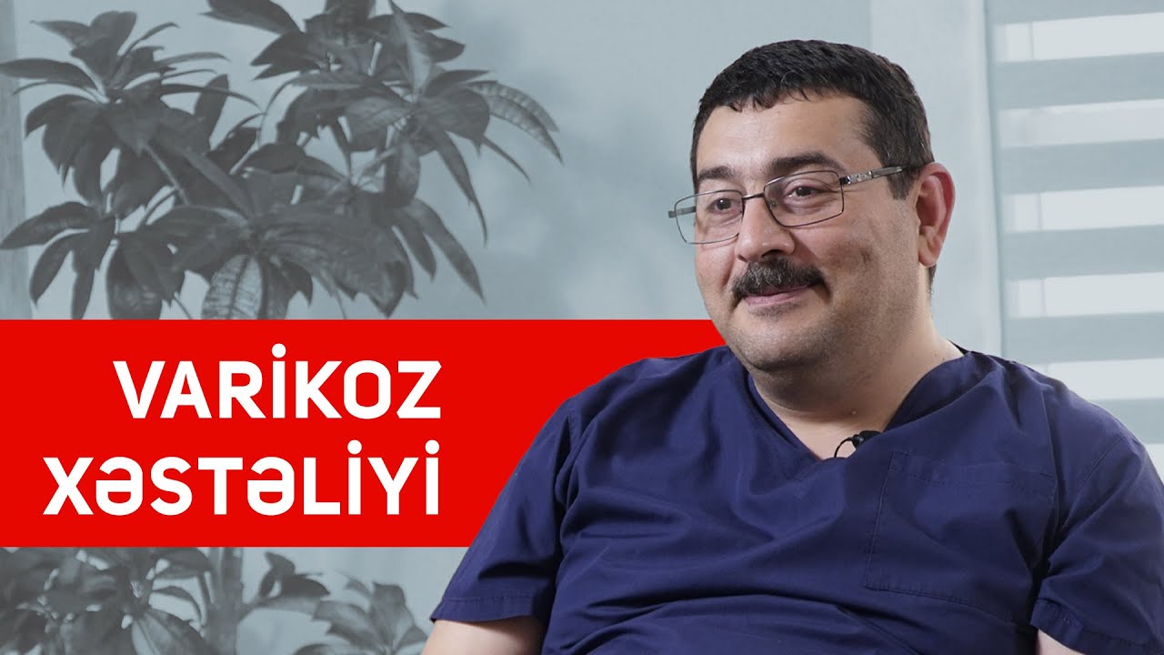 Varikoz xəstəliyi