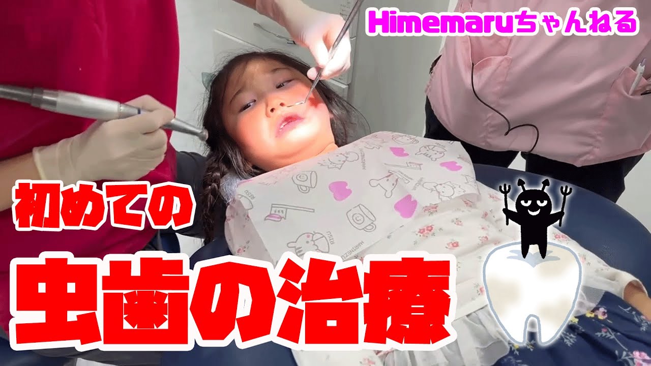 【歯医者さん】5歳の女の子が初めての虫歯の治療！　子供　ひめまるちゃんねる　ひめまる dentist