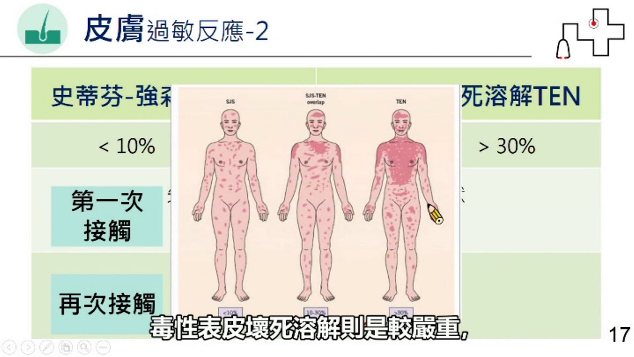 藥物過敏